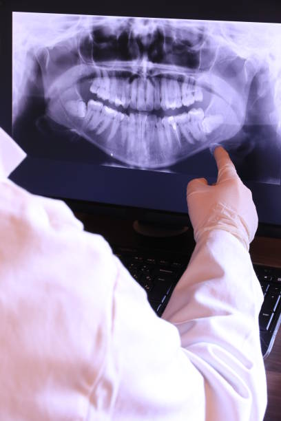 Best Chipped Tooth Repair Near Me  in Fifth Ward, LA