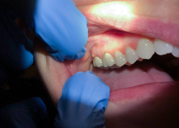 Best Dentist for Dental Trauma  in Fifth Ward, LA